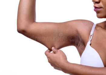 4 main causes of loose skin and how to avoid loose skin after weight loss