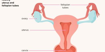 Pelvic Inflammatory Disease